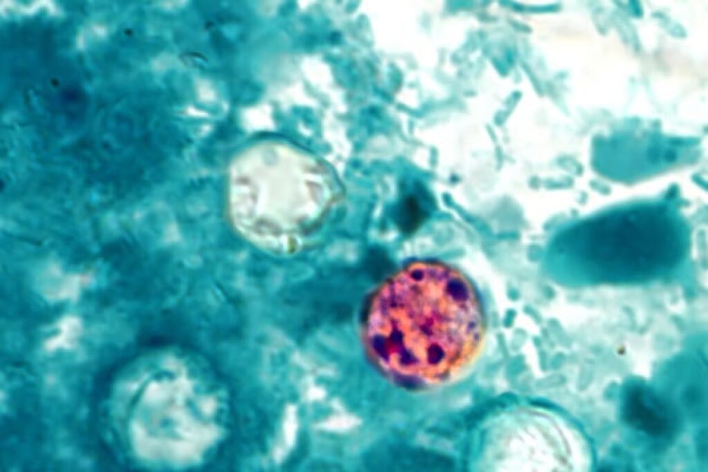 What to know about cyclosporiasis cases, prevention in the Pittsburgh area What to know about cyclosporiasis cases, prevention in the Pittsburgh area